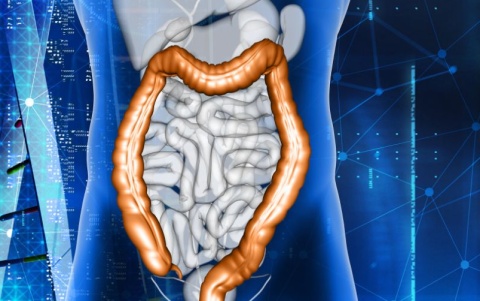 Δωρεάν πληθυσμιακός έλεγχος για τον καρκίνο του παχέος εντέρου